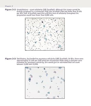 Practical Guide to Gynecologic Cytopathology, Morphology and